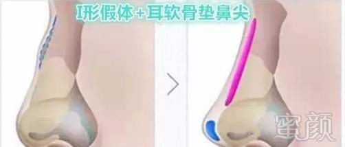https://img.miyanlife.com/mnt/timg/180831/105TKc2-1.jpg