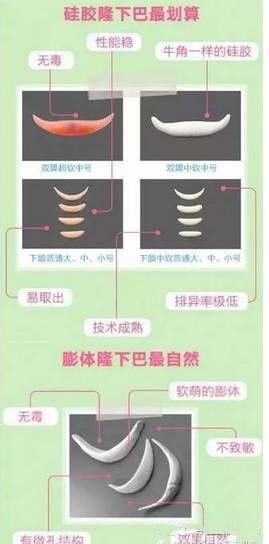 https://img.miyanlife.com/mnt/timg/180831/105TLb0-4.jpg