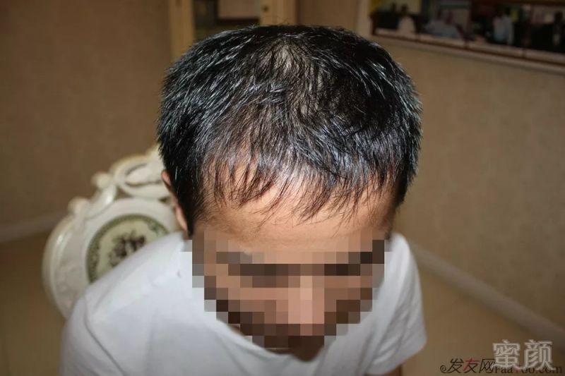 https://img.miyanlife.com/mnt/timg/180831/11044C624-6.jpg