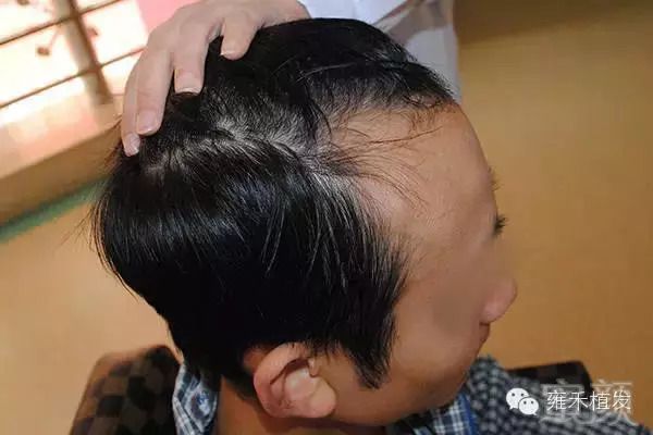 https://img.miyanlife.com/mnt/timg/180831/1106101411-2.jpg
