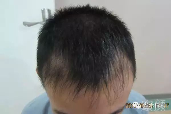https://img.miyanlife.com/mnt/timg/180831/110611I59-8.jpg
