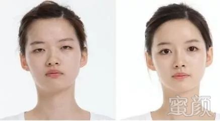 https://img.miyanlife.com/mnt/timg/180831/11212W946-7.jpg