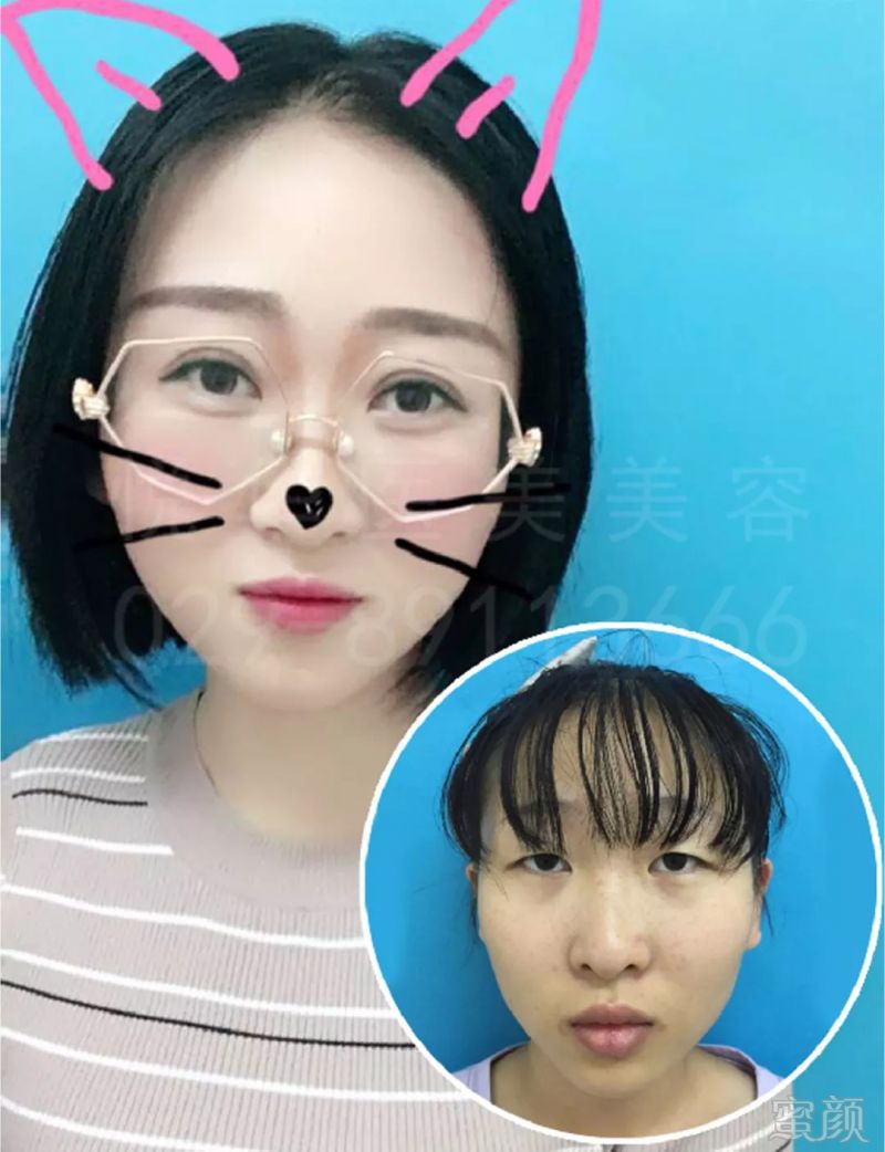 https://img.miyanlife.com/mnt/timg/180831/11221Gc2-7.jpg