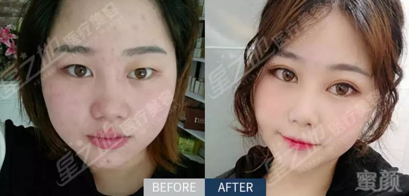 https://img.miyanlife.com/mnt/timg/180831/11311RP6-1.jpg