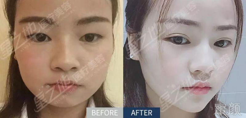 https://img.miyanlife.com/mnt/timg/180831/11312110C-4.jpg
