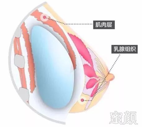 案例图片