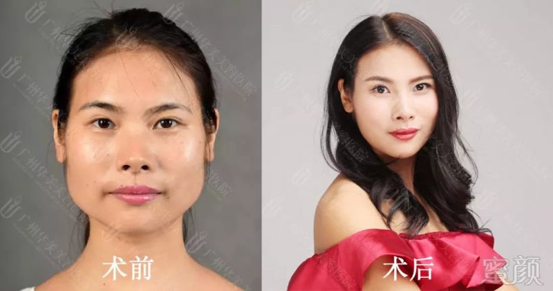 https://img.miyanlife.com/mnt/timg/180831/1240132W9-2.jpg