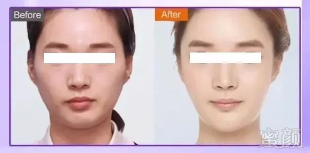 https://img.miyanlife.com/mnt/timg/180831/1240143T5-4.jpg