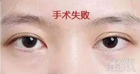 https://img.miyanlife.com/mnt/timg/180831/1252432532-0.jpg