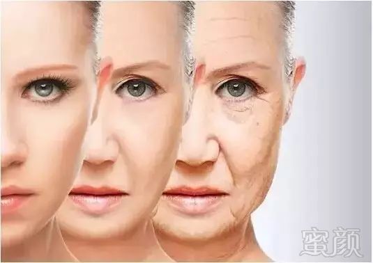 https://img.miyanlife.com/mnt/timg/180831/12544CA1-0.jpg