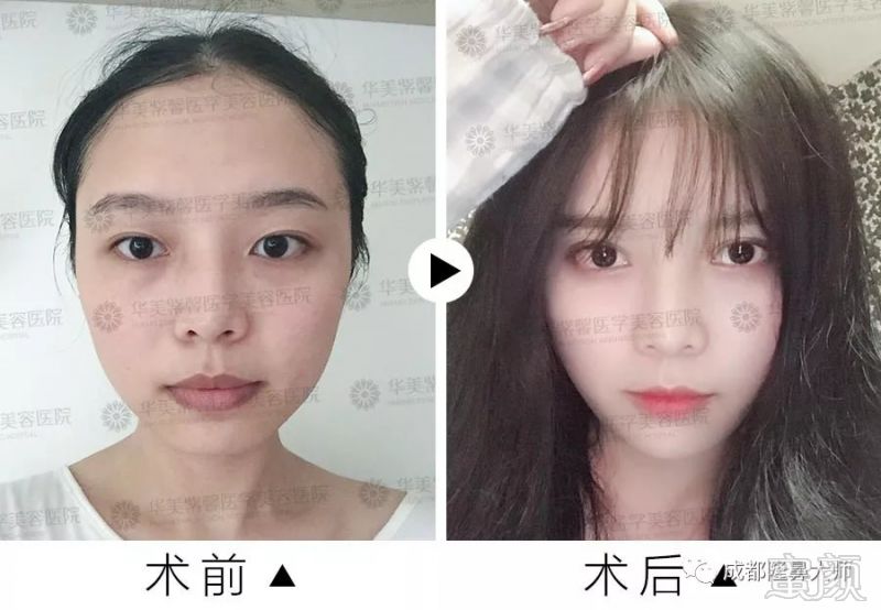 https://img.miyanlife.com/mnt/timg/180831/130U643I-8.jpg