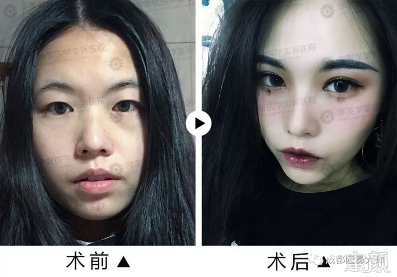 https://img.miyanlife.com/mnt/timg/180831/130UKC6-10.jpg