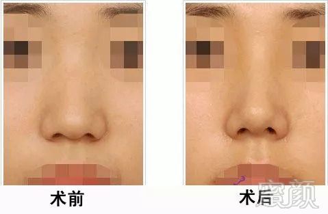 https://img.miyanlife.com/mnt/timg/180831/131P95117-4.jpg