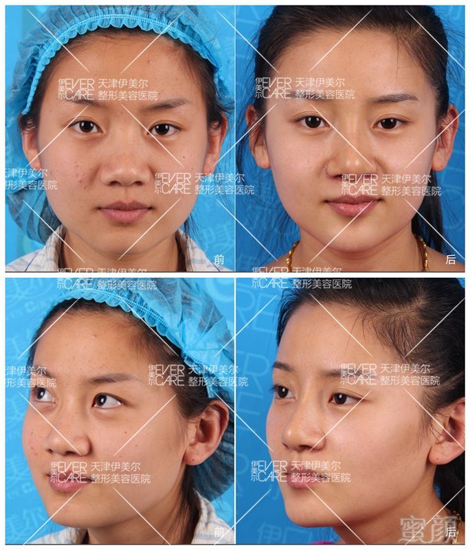 https://img.miyanlife.com/mnt/timg/180831/1333291945-5.jpg