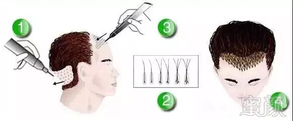 https://img.miyanlife.com/mnt/timg/180831/133T1I58-2.jpg