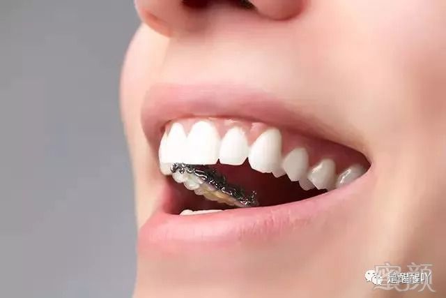https://img.miyanlife.com/mnt/timg/180831/1345293U6-7.jpg