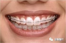 https://img.miyanlife.com/mnt/timg/180831/13452a2O-5.jpg