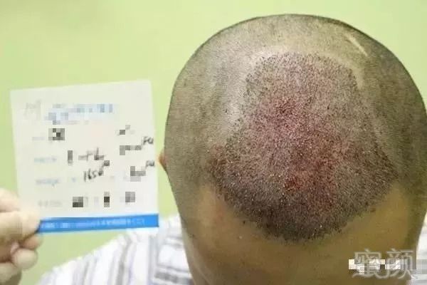 https://img.miyanlife.com/mnt/timg/180831/13464U362-4.jpg