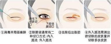 https://img.miyanlife.com/mnt/timg/180831/14130124O-0.jpg