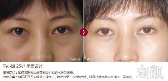 https://img.miyanlife.com/mnt/timg/180831/1413024057-4.jpg