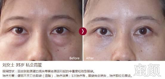 https://img.miyanlife.com/mnt/timg/180831/1413025D8-5.jpg