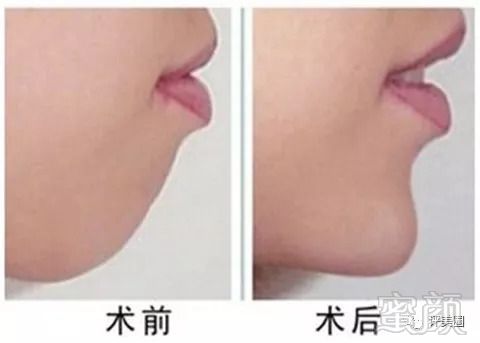 https://img.miyanlife.com/mnt/timg/180901/10342R524-0.jpg