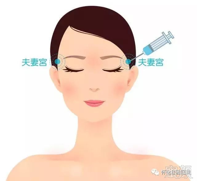 https://img.miyanlife.com/mnt/timg/180901/11222A932-7.jpg