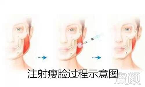 https://img.miyanlife.com/mnt/timg/180901/1124164Z3-7.jpg