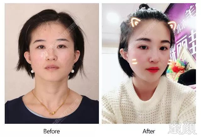 https://img.miyanlife.com/mnt/timg/180901/11241QE9-11.jpg