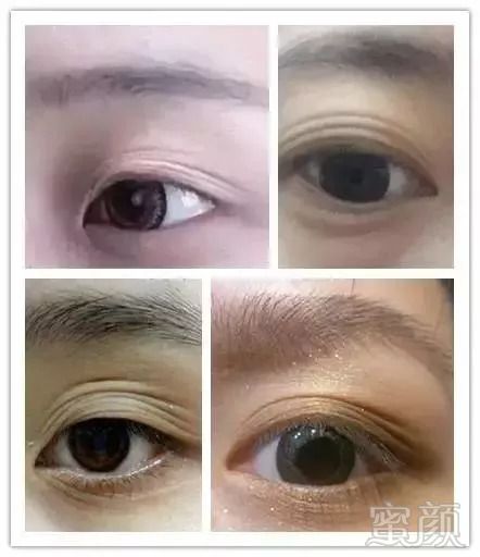https://img.miyanlife.com/mnt/timg/180901/1212594516-3.jpg