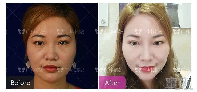 https://img.miyanlife.com/mnt/timg/180901/121504F08-3.jpg