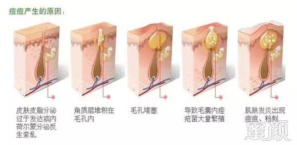https://img.miyanlife.com/mnt/timg/180901/122400F20-5.jpg