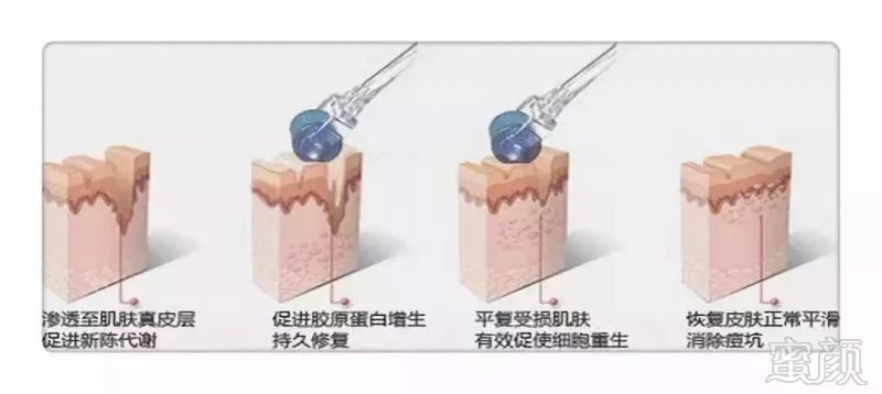 https://img.miyanlife.com/mnt/timg/180901/1224024S0-8.jpg