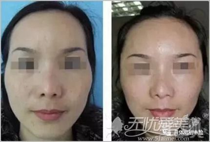 https://img.miyanlife.com/mnt/timg/180901/1322421Z6-1.jpg