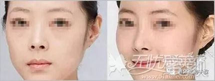 https://img.miyanlife.com/mnt/timg/180901/13224263K-2.jpg