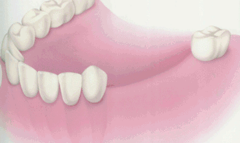 https://img.miyanlife.com/mnt/timg/180901/133J0H62-7.jpg