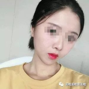 https://img.miyanlife.com/mnt/timg/180901/14054M021-3.jpg