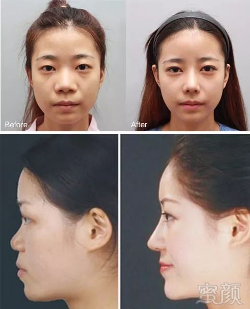 https://img.miyanlife.com/mnt/timg/180901/142UC428-3.jpg