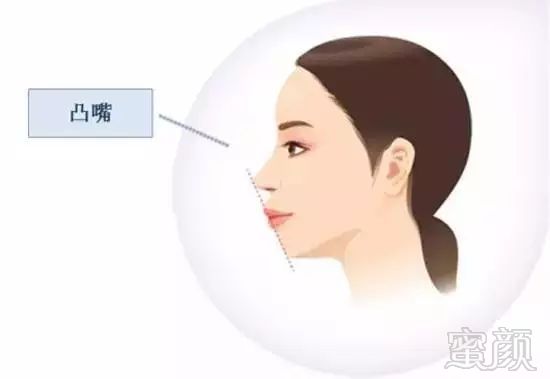 https://img.miyanlife.com/mnt/timg/180902/10491S348-4.jpg