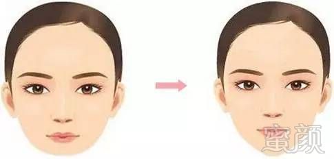 https://img.miyanlife.com/mnt/timg/180902/10491WR4-3.jpg