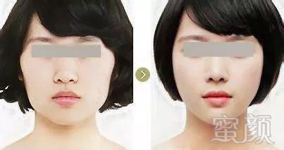https://img.miyanlife.com/mnt/timg/180902/111304B32-10.jpg