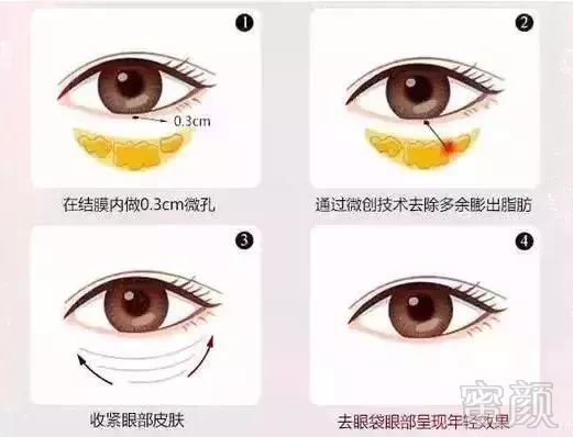 https://img.miyanlife.com/mnt/timg/180902/11363CC8-6.jpg