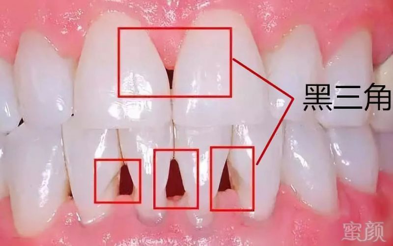 https://img.miyanlife.com/mnt/timg/180902/1139252G3-1.jpg