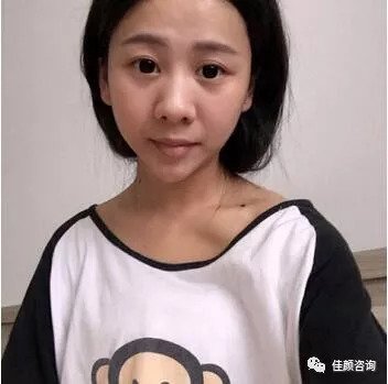 https://img.miyanlife.com/mnt/timg/180902/11425CY7-0.jpg