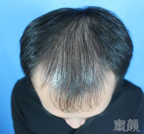 https://img.miyanlife.com/mnt/timg/180902/1144295Q6-2.jpg