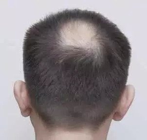 https://img.miyanlife.com/mnt/timg/180902/1144295Z9-1.jpg