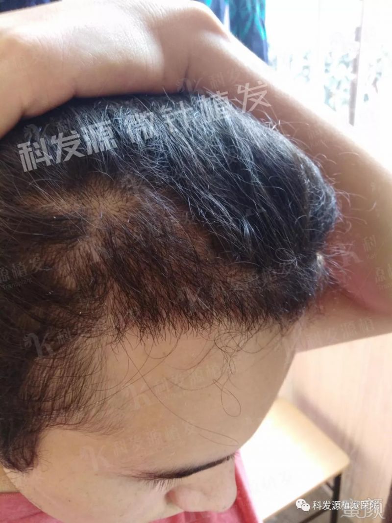 https://img.miyanlife.com/mnt/timg/180902/11492U5Z-12.jpg