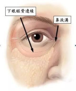 https://img.miyanlife.com/mnt/timg/180902/115144O28-3.jpg