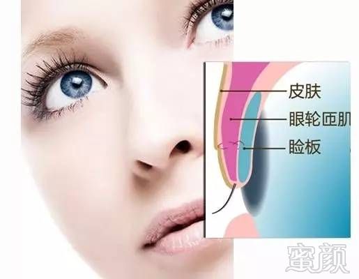https://img.miyanlife.com/mnt/timg/180902/11515J5D-9.jpg