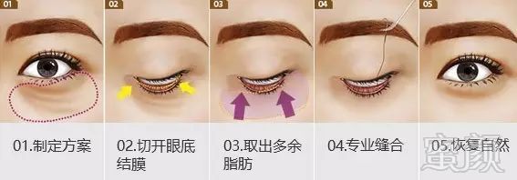 https://img.miyanlife.com/mnt/timg/180902/11515UY5-13.jpg